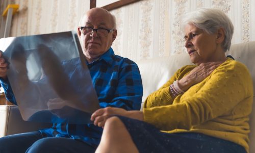 Elderly caucasian heterosexual couple worried about lungs x-ray results. Healthcare concept. High quality photo
